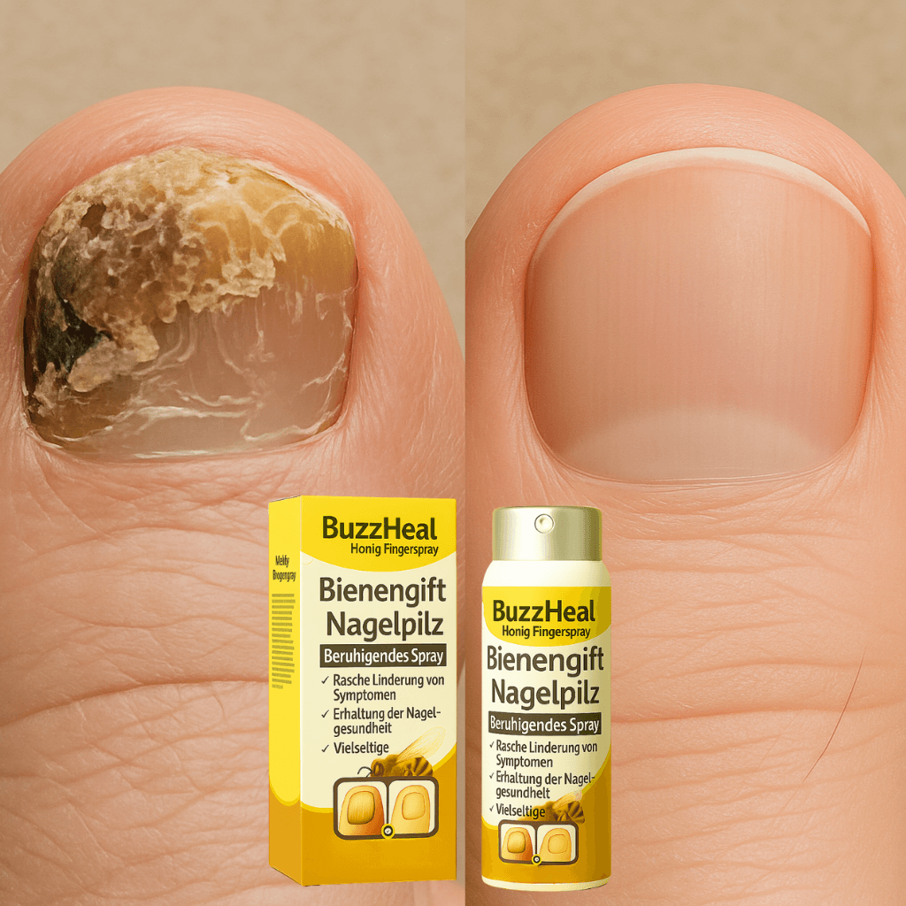 BuzzHeal Anti-Pilz-Nagelspray
