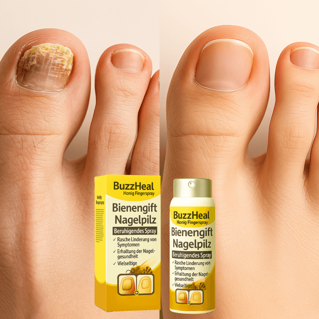 BuzzHeal Anti-Pilz-Nagelspray
